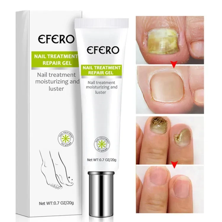 Efero Nail Repair Treatment Gel Fungus Cream-20gm